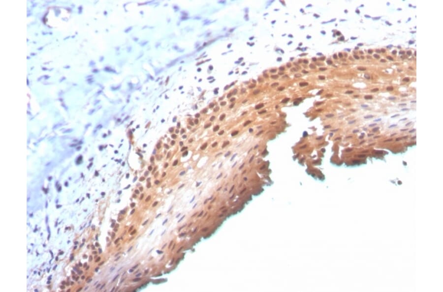 Immunohistochemistry - Anti-p16INK4a Antibody [CDKN2A/3830] - BSA and Azide free (A251287) - Antibodies.com