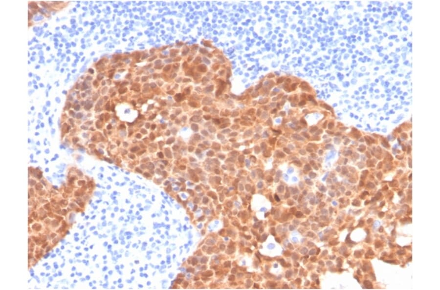 Immunohistochemistry - Anti-p16INK4a Antibody [CDKN2A/4499] - BSA and Azide free (A251289) - Antibodies.com