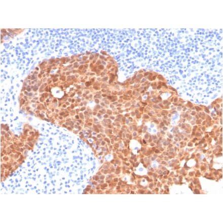 Immunohistochemistry - Anti-p16INK4a Antibody [CDKN2A/4499] - BSA and Azide free (A251289) - Antibodies.com