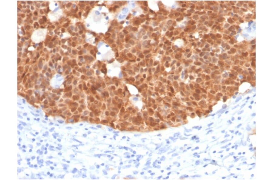 Immunohistochemistry - Anti-p16INK4a Antibody [CDKN2A/4499] - BSA and Azide free (A251288) - Antibodies.com