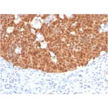 Immunohistochemistry - Anti-p16INK4a Antibody [CDKN2A/4499] - BSA and Azide free (A251288) - Antibodies.com