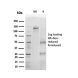 SDS-PAGE - Anti-p16INK4a Antibody [CDKN2A/4499] - BSA and Azide free (A251289) - Antibodies.com