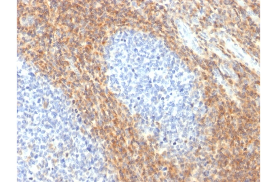 Immunohistochemistry - Anti-CD52 Antibody [CD52/2276R] - BSA and Azide free (A251292) - Antibodies.com