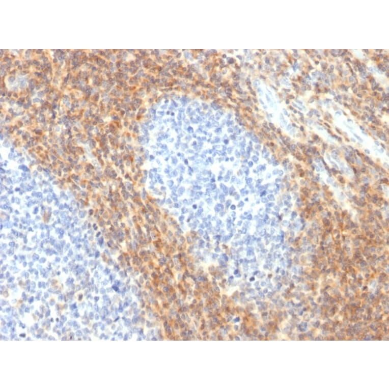 Immunohistochemistry - Anti-CD52 Antibody [CD52/2276R] - BSA and Azide free (A251292) - Antibodies.com