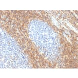 Immunohistochemistry - Anti-CD52 Antibody [CD52/2276R] - BSA and Azide free (A251292) - Antibodies.com