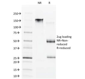 SDS-PAGE - Anti-CDX1 Antibody [CDX1/1650] - BSA and Azide free (A251292) - Antibodies.com