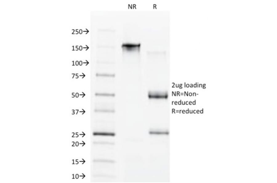 SDS-PAGE - Anti-CDX1 Antibody [CDX1/1650] - BSA and Azide free (A251292) - Antibodies.com