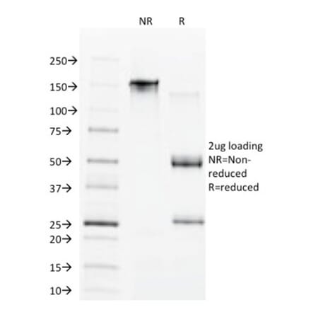SDS-PAGE - Anti-CDX1 Antibody [CDX1/1650] - BSA and Azide free (A251292) - Antibodies.com