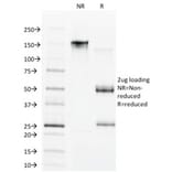 SDS-PAGE - Anti-CDX1 Antibody [CDX1/1650] - BSA and Azide free (A251292) - Antibodies.com