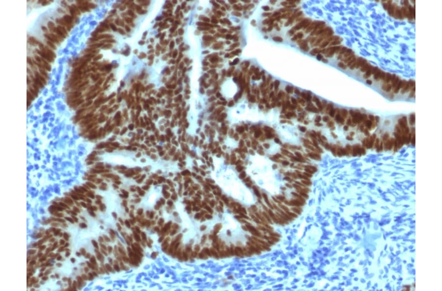 Immunohistochemistry - Anti-CDX2 Antibody [CDX2/1690] - BSA and Azide free (A251294) - Antibodies.com