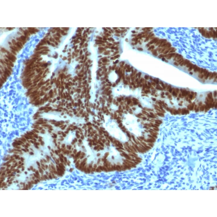 Immunohistochemistry - Anti-CDX2 Antibody [CDX2/1690] - BSA and Azide free (A251294) - Antibodies.com