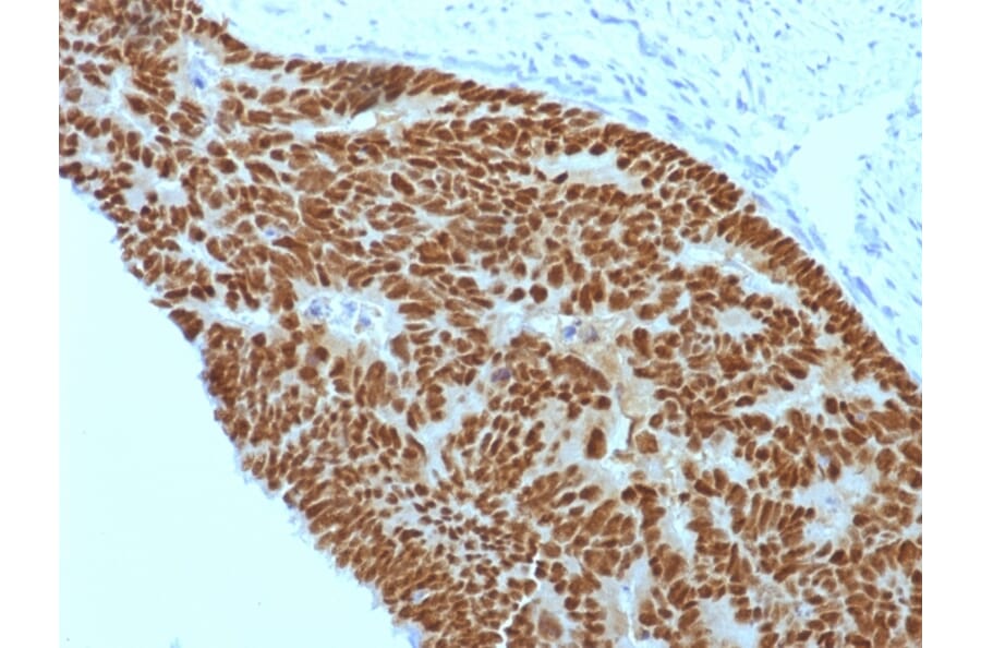 Immunohistochemistry - Anti-CDX2 Antibody [CDX2/1690] - BSA and Azide free (A251294) - Antibodies.com