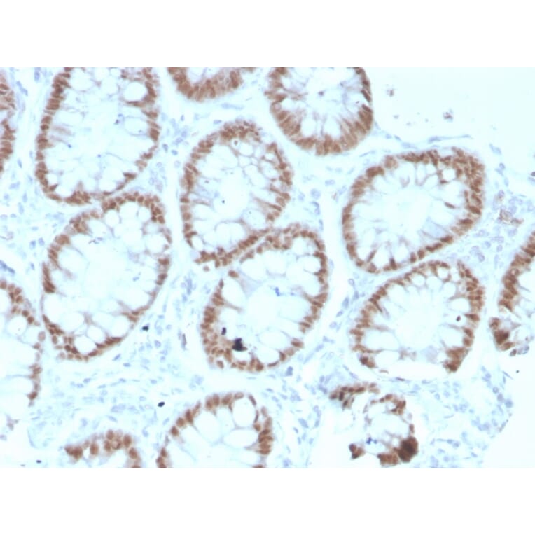 Immunohistochemistry - Anti-CDX2 Antibody [rCDX2/1690] - BSA and Azide free (A251297) - Antibodies.com