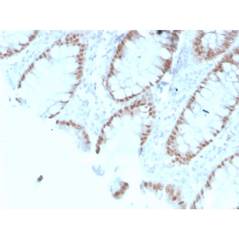 Immunohistochemistry - Anti-CDX2 Antibody [rCDX2/1690] - BSA and Azide free (A251296) - Antibodies.com