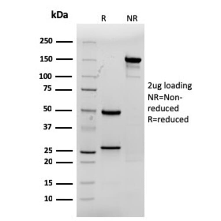 SDS-PAGE - Anti-CDX2 Antibody [rCDX2/1690] - BSA and Azide free (A251297) - Antibodies.com