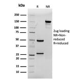 SDS-PAGE - Anti-CDX2 Antibody [rCDX2/1690] - BSA and Azide free (A251297) - Antibodies.com