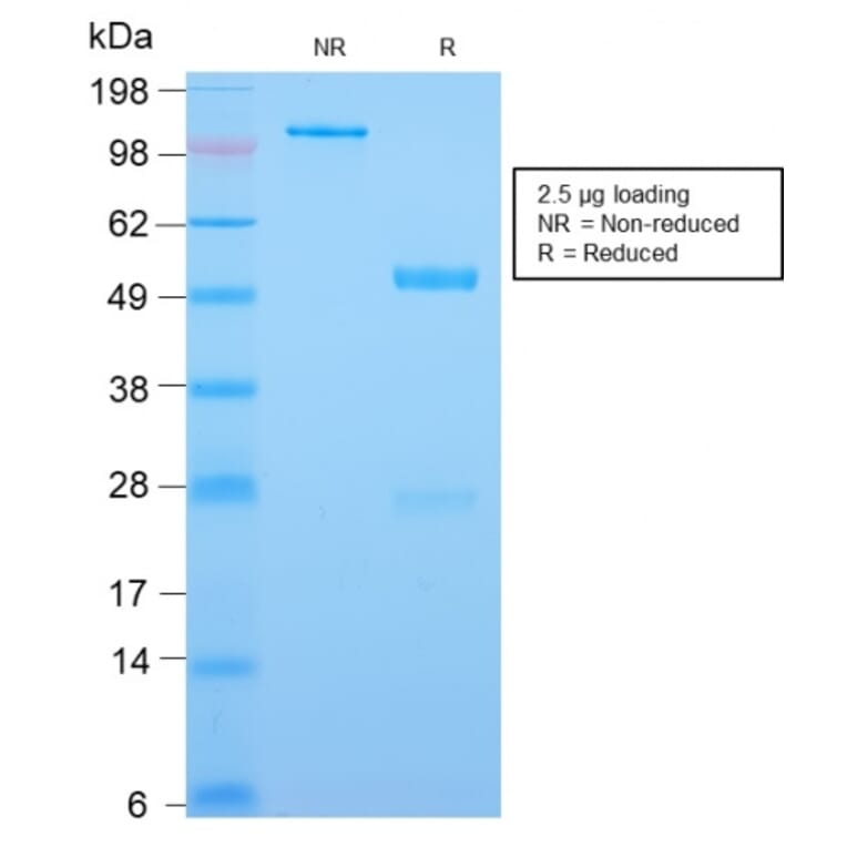 SDS-PAGE - Anti-CDX2 Antibody [CDX2/2951R] - BSA and Azide free (A251298) - Antibodies.com