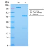 SDS-PAGE - Anti-CDX2 Antibody [CDX2/2951R] - BSA and Azide free (A251298) - Antibodies.com