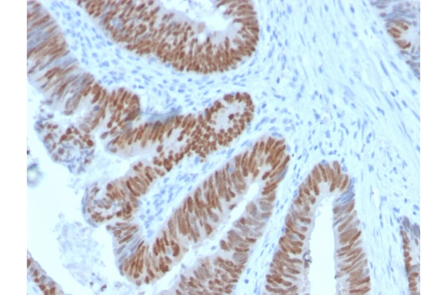Immunohistochemistry - Anti-CDX2 Antibody [CDX2/2951R] - BSA and Azide free (A251297) - Antibodies.com