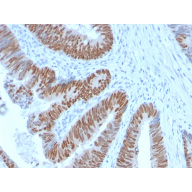 Immunohistochemistry - Anti-CDX2 Antibody [CDX2/2951R] - BSA and Azide free (A251297) - Antibodies.com