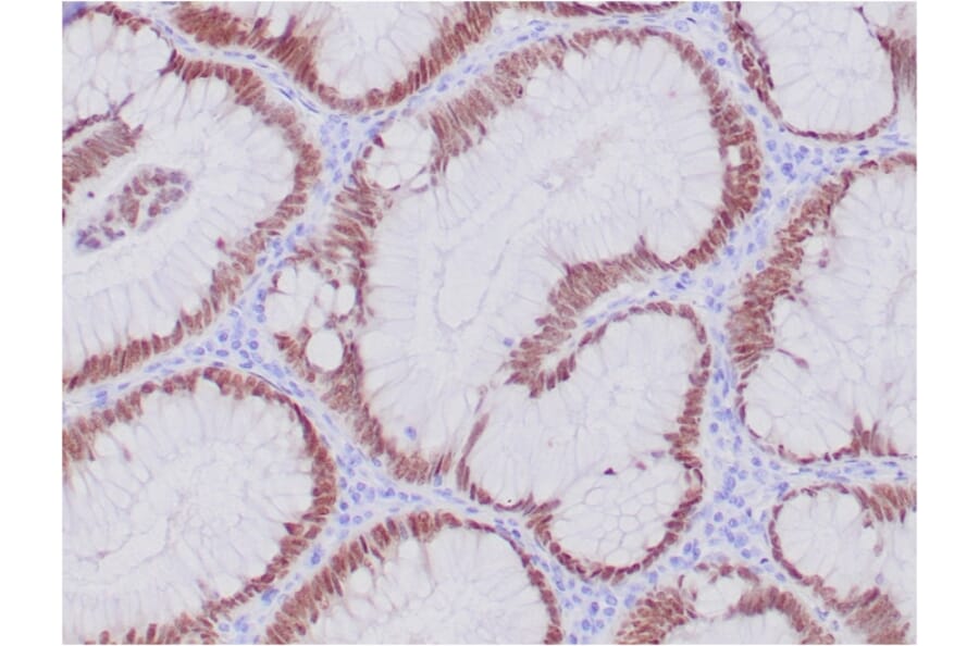 Immunohistochemistry - Anti-CDX2 Antibody [CDX2/4394R] - BSA and Azide free (A251298) - Antibodies.com