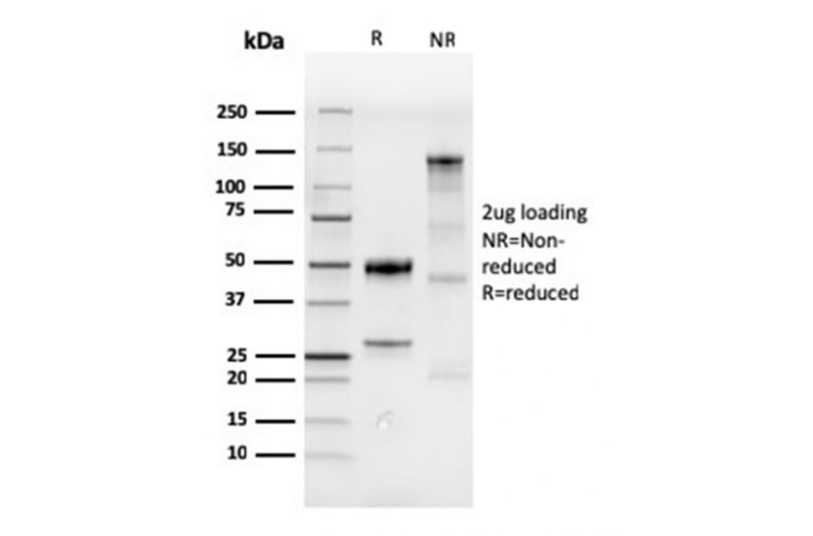 SDS-PAGE - Anti-CDX2 Antibody [CDX2/4394R] - BSA and Azide free (A251299) - Antibodies.com