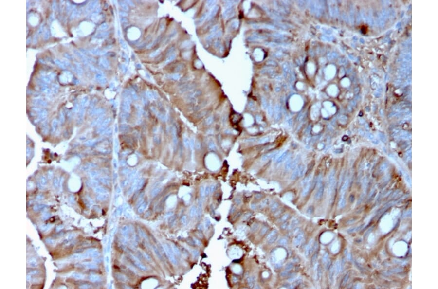 Immunohistochemistry - Anti-MerTK Antibody [MERTK/3015] - BSA and Azide free (A251300) - Antibodies.com