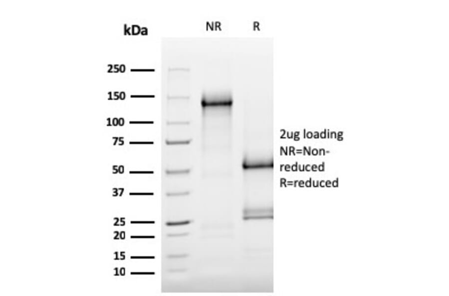 SDS-PAGE - Anti-MerTK Antibody [MERTK/3015] - BSA and Azide free (A251300) - Antibodies.com
