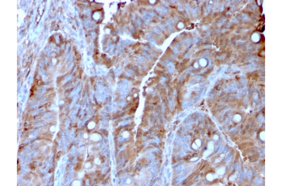 Immunohistochemistry - Anti-MerTK Antibody [MERTK/3022] - BSA and Azide free (A251301) - Antibodies.com