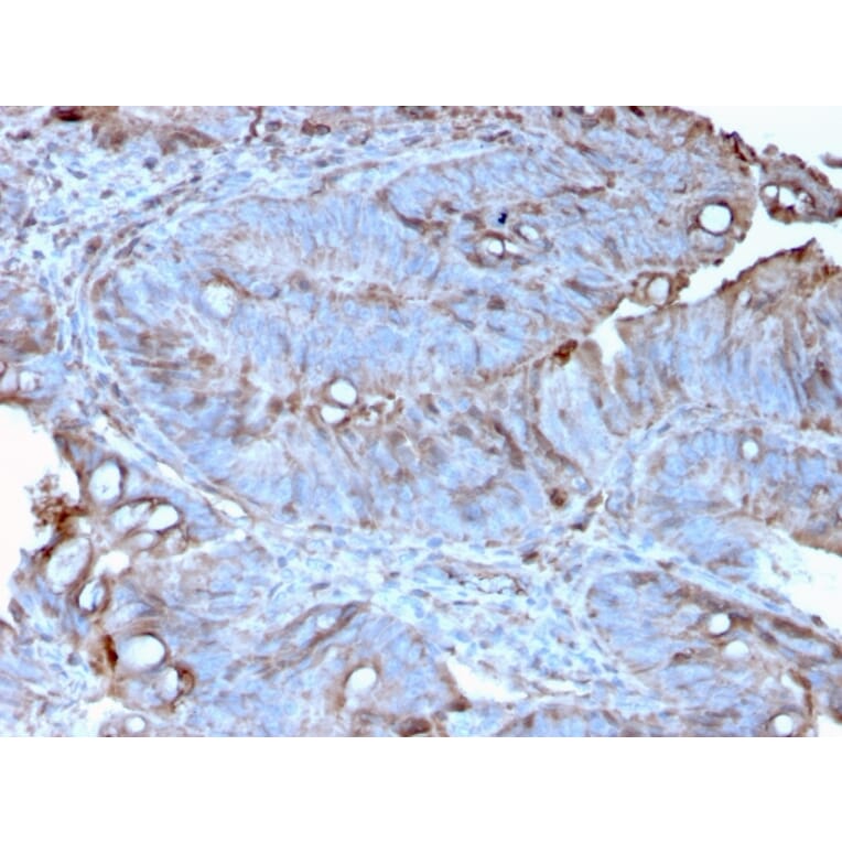Immunohistochemistry - Anti-MerTK Antibody [MERTK/3022] - BSA and Azide free (A251301) - Antibodies.com