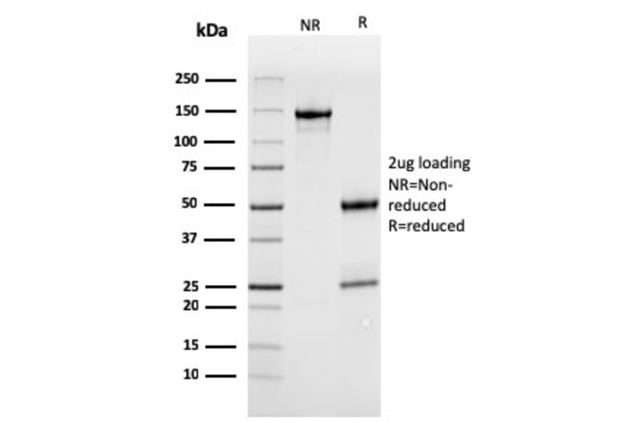 SDS-PAGE - Anti-MerTK Antibody [MERTK/3022] - BSA and Azide free (A251301) - Antibodies.com