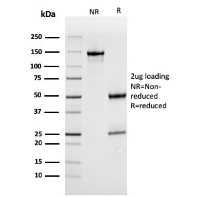 SDS-PAGE - Anti-MerTK Antibody [MERTK/3022] - BSA and Azide free (A251301) - Antibodies.com