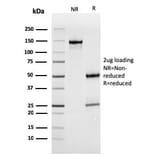 SDS-PAGE - Anti-MerTK Antibody [MERTK/3022] - BSA and Azide free (A251301) - Antibodies.com