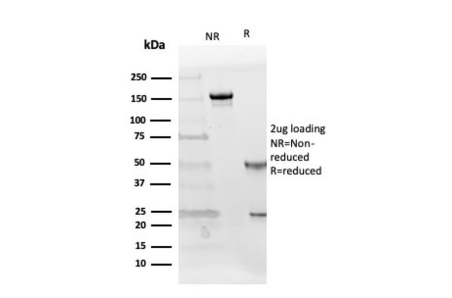 SDS-PAGE - Anti-Follistatin Antibody [FST/4281] - BSA and Azide free (A251302) - Antibodies.com