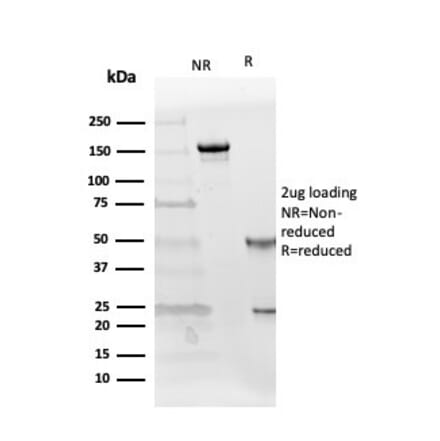 SDS-PAGE - Anti-Follistatin Antibody [FST/4281] - BSA and Azide free (A251302) - Antibodies.com