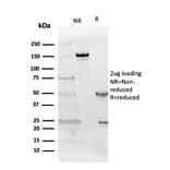 SDS-PAGE - Anti-Follistatin Antibody [FST/4281] - BSA and Azide free (A251302) - Antibodies.com