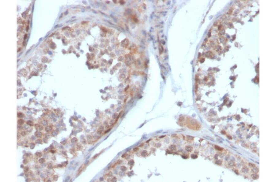 Immunohistochemistry - Anti-Follistatin Antibody [FST/4281] - BSA and Azide free (A251301) - Antibodies.com