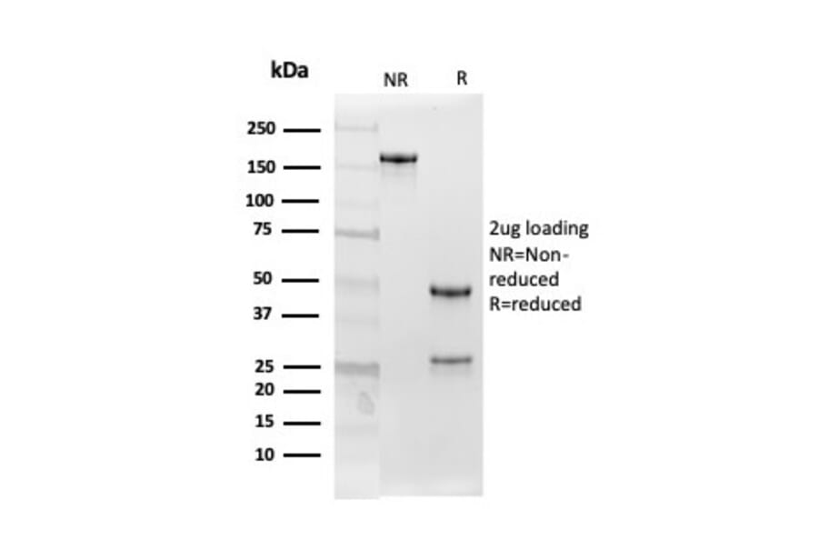 SDS-PAGE - Anti-Follistatin Antibody [FST/4282] - BSA and Azide free (A251302) - Antibodies.com