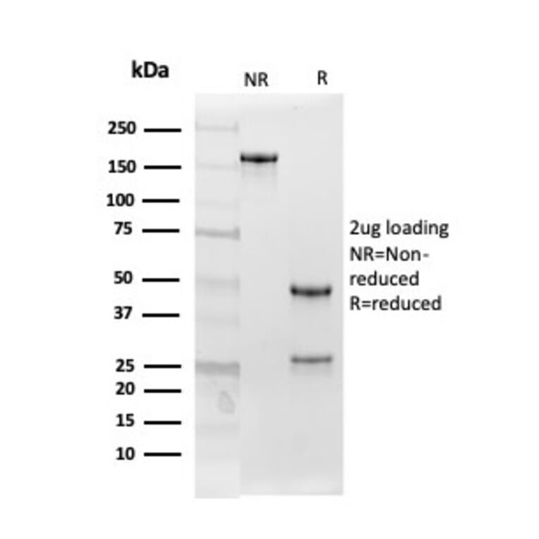 SDS-PAGE - Anti-Follistatin Antibody [FST/4282] - BSA and Azide free (A251302) - Antibodies.com