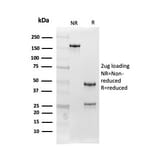 SDS-PAGE - Anti-Follistatin Antibody [FST/4282] - BSA and Azide free (A251302) - Antibodies.com