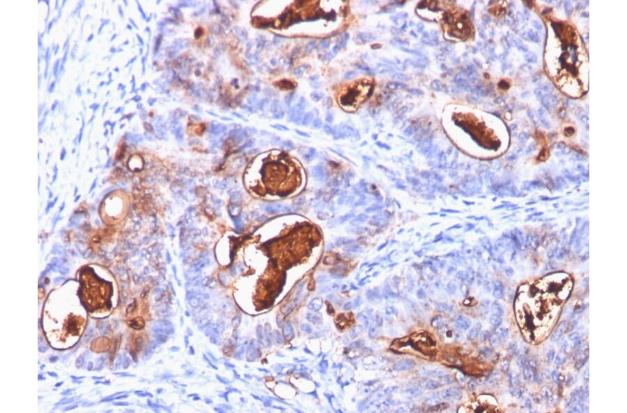 Immunohistochemistry - Anti-Carcinoembryonic Antigen Antibody [C66/1260] - BSA and Azide free (A251303) - Antibodies.com