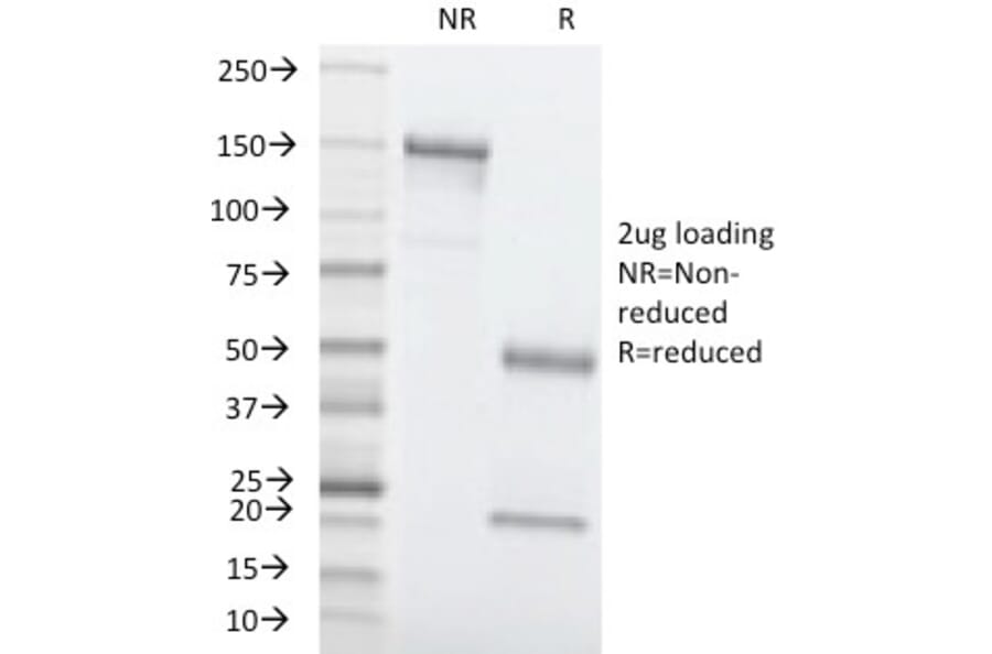 SDS-PAGE - Anti-Carcinoembryonic Antigen Antibody [C66/1260] - BSA and Azide free (A251304) - Antibodies.com