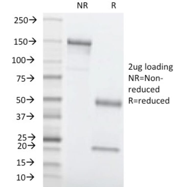 SDS-PAGE - Anti-Carcinoembryonic Antigen Antibody [C66/1260] - BSA and Azide free (A251304) - Antibodies.com