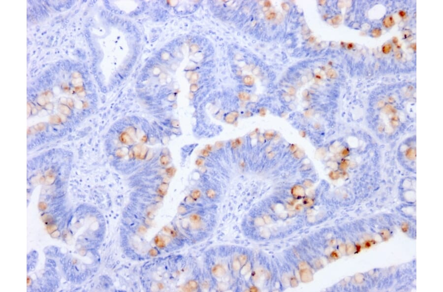 Immunohistochemistry - Anti-Carcinoembryonic Antigen Antibody [C66/1291] - BSA and Azide free (A251304) - Antibodies.com