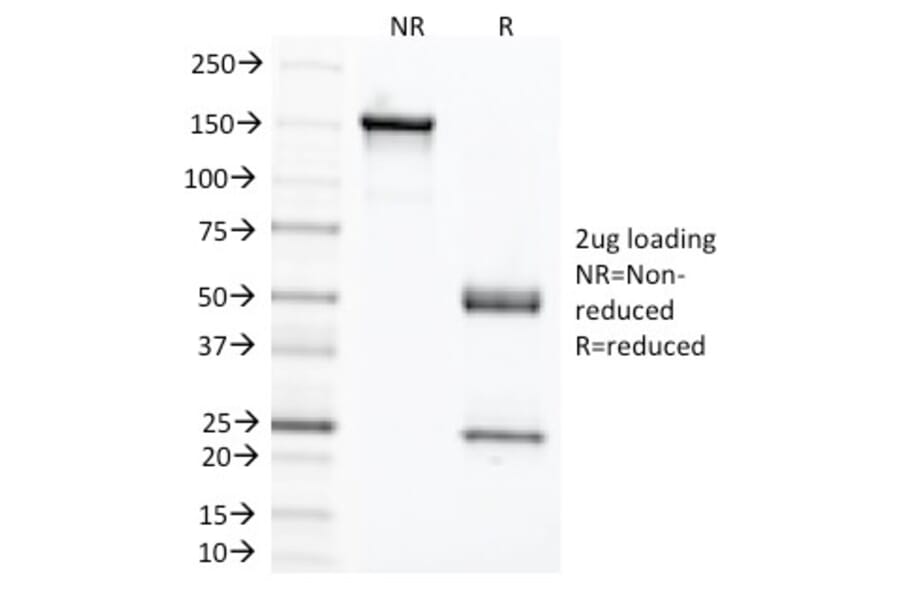 SDS-PAGE - Anti-Carcinoembryonic Antigen Antibody [C66/1291] - BSA and Azide free (A251305) - Antibodies.com