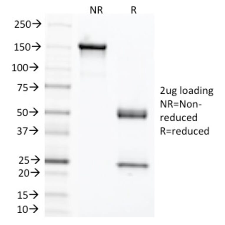 SDS-PAGE - Anti-Carcinoembryonic Antigen Antibody [C66/1291] - BSA and Azide free (A251305) - Antibodies.com