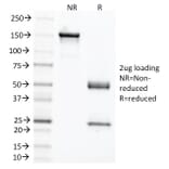 SDS-PAGE - Anti-Carcinoembryonic Antigen Antibody [C66/1291] - BSA and Azide free (A251305) - Antibodies.com