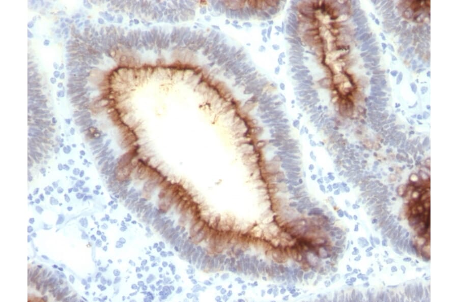 Immunohistochemistry - Anti-Carcinoembryonic Antigen Antibody [rC66/1009] - BSA and Azide free (A251305) - Antibodies.com