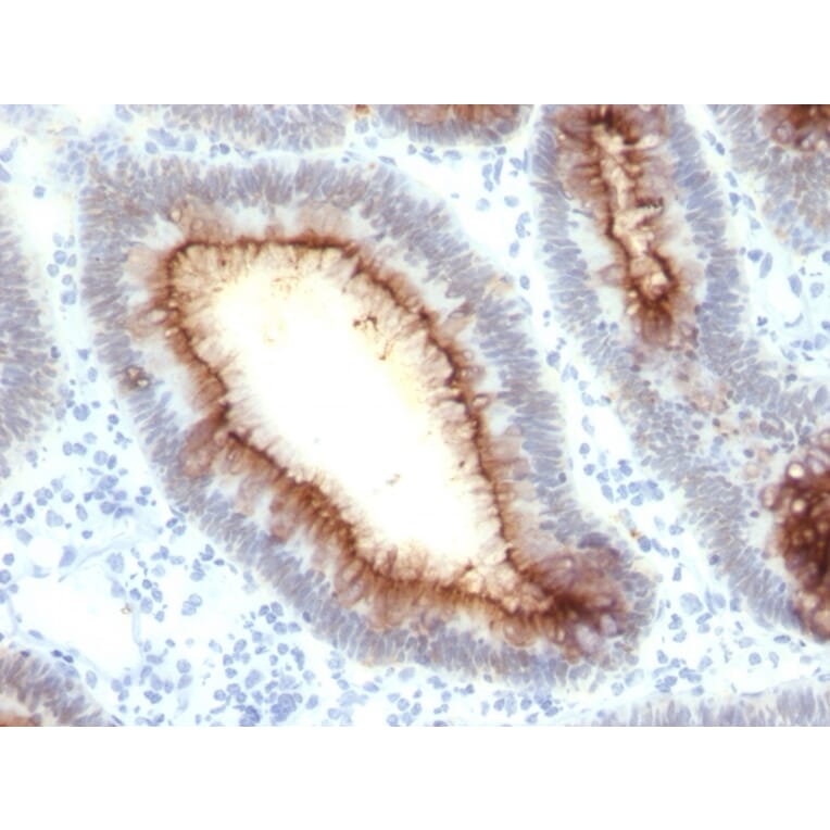 Immunohistochemistry - Anti-Carcinoembryonic Antigen Antibody [rC66/1009] - BSA and Azide free (A251305) - Antibodies.com
