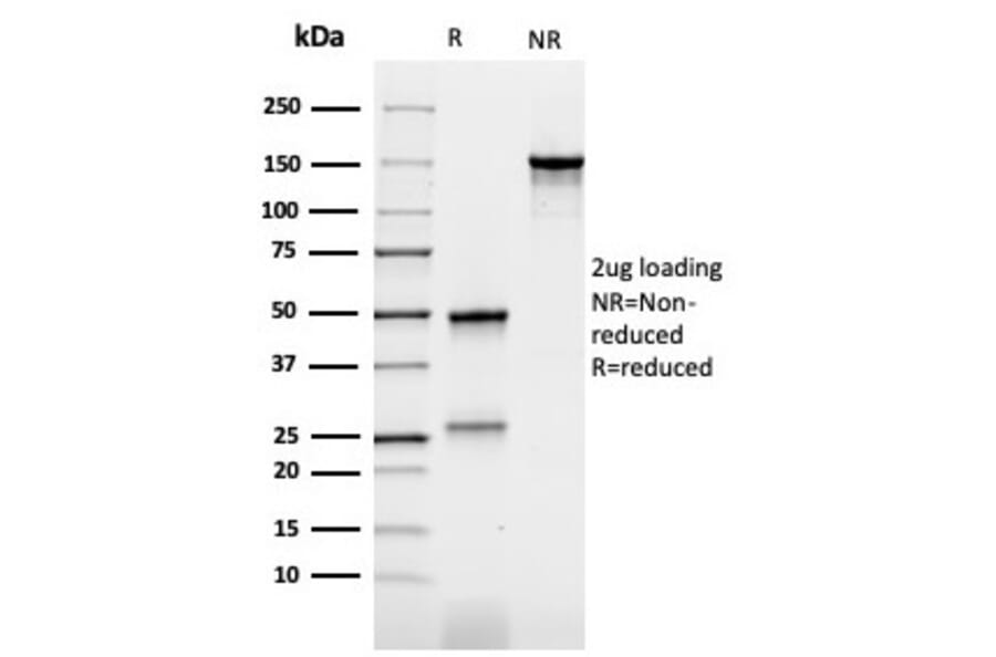 SDS-PAGE - Anti-Carcinoembryonic Antigen Antibody [rC66/1009] - BSA and Azide free (A251307) - Antibodies.com